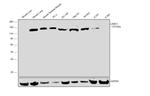 Laminin gamma-1 Antibody in Western Blot (WB)