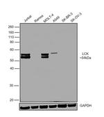 LCK Antibody in Western Blot (WB)