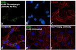 NGAL Antibody