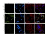 LIF Antibody in Immunocytochemistry (ICC/IF)