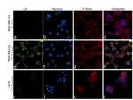 LIF Antibody in Immunocytochemistry (ICC/IF)