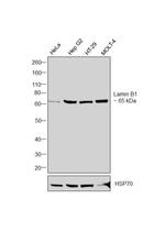 Lamin B1 Antibody in Western Blot (WB)