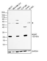 MGMT Antibody in Western Blot (WB)