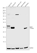 MMP7 Antibody in Western Blot (WB)