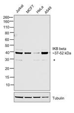 IkB beta Antibody in Western Blot (WB)