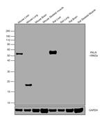 PKLR Antibody in Western Blot (WB)