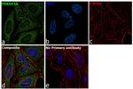 PRKAR1A Antibody in Immunocytochemistry (ICC/IF)