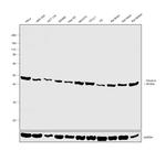 PRKAR1A Antibody in Western Blot (WB)