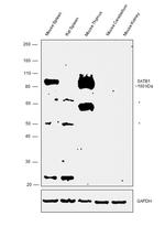 SATB1 Antibody in Western Blot (WB)