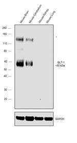 GLT-1 Antibody in Western Blot (WB)