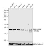 SMN1/SMN2 Antibody in Western Blot (WB)
