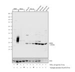 SOD2 (MnSOD) Antibody in Western Blot (WB)