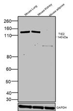 TIE2 (TEK) Antibody in Western Blot (WB)