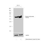 Tyrosine Hydroxylase Antibody in Western Blot (WB)