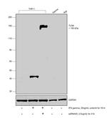 TLR8 Antibody in Western Blot (WB)