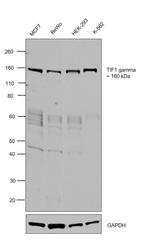 TIF1 gamma Antibody in Western Blot (WB)