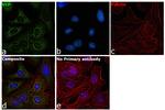 VCP Antibody in Immunocytochemistry (ICC/IF)