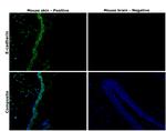 E-cadherin Antibody in Immunohistochemistry (Paraffin) (IHC (P))