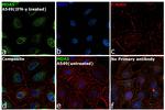 MDA5 Antibody