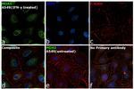 MDA5 Antibody in Immunocytochemistry (ICC/IF)
