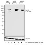 MDA5 Antibody in Western Blot (WB)