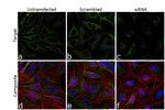 Nesprin 1 Antibody in Immunocytochemistry (ICC/IF)