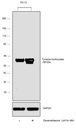 Tyrosine Hydroxylase Antibody in Western Blot (WB)