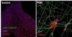 beta-3 Tubulin Antibody in Immunocytochemistry (ICC/IF)