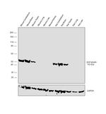 Beta III Tubulin Antibody