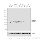 beta-3 Tubulin Antibody in Western Blot (WB)