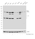 STAT3 Antibody in Western Blot (WB)