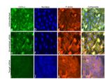 CXCL1 Antibody in Immunocytochemistry (ICC/IF)