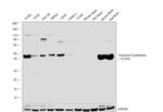 Glutamine Synthetase Antibody in Western Blot (WB)