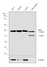 SGK1 Antibody in Western Blot (WB)