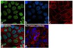 CTCF Antibody in Immunocytochemistry (ICC/IF)