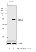 IRAK-M Antibody in Western Blot (WB)