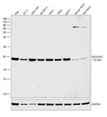 NDUFAF2 Antibody in Western Blot (WB)