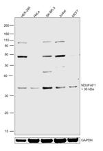 NDUFAF1 Antibody in Western Blot (WB)