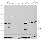 ILK Antibody in Western Blot (WB)