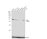 DDB2 Antibody in Western Blot (WB)