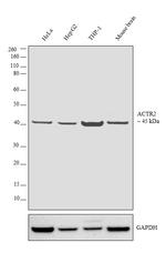 Arp2 Antibody in Western Blot (WB)
