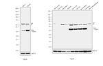 KHK Antibody in Western Blot (WB)