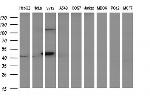 PAAF1 Antibody in Western Blot (WB)