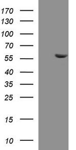 PAAF1 Antibody in Western Blot (WB)