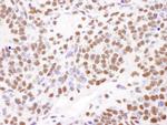 PABPN1 Antibody in Immunohistochemistry (IHC)