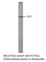 Adenylate cyclase 1 Antibody in Western Blot (WB)