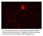 ADCY5 Antibody in Immunohistochemistry (IHC)