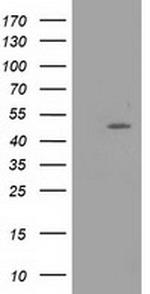 PACSIN3 Antibody in Western Blot (WB)