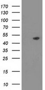 PACSIN3 Antibody in Western Blot (WB)