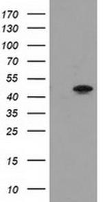 PACSIN3 Antibody in Western Blot (WB)